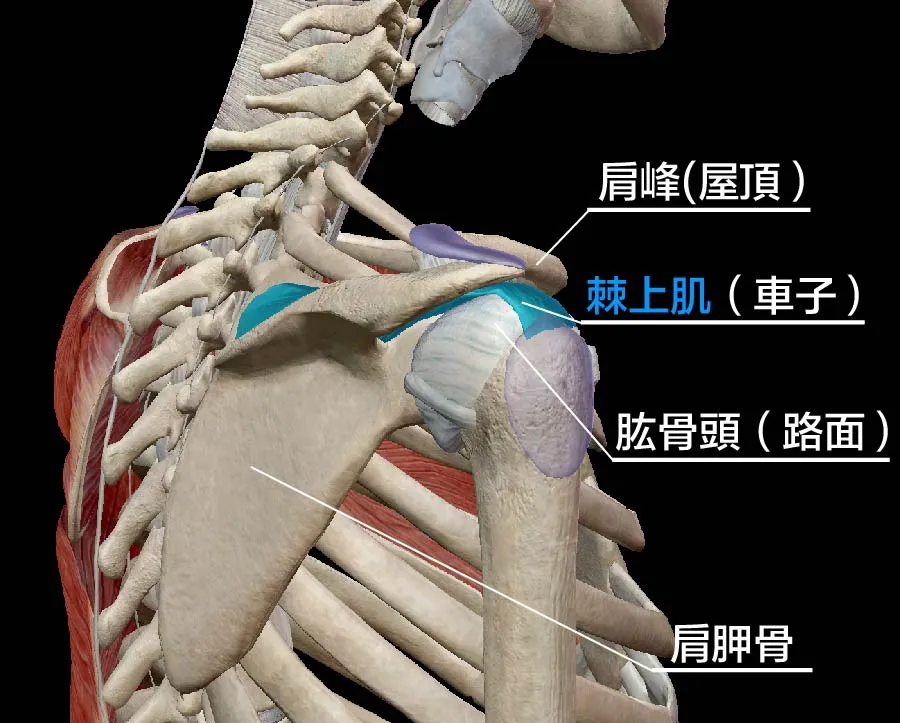 肩膀痛,肩夾擠症候群示意圖