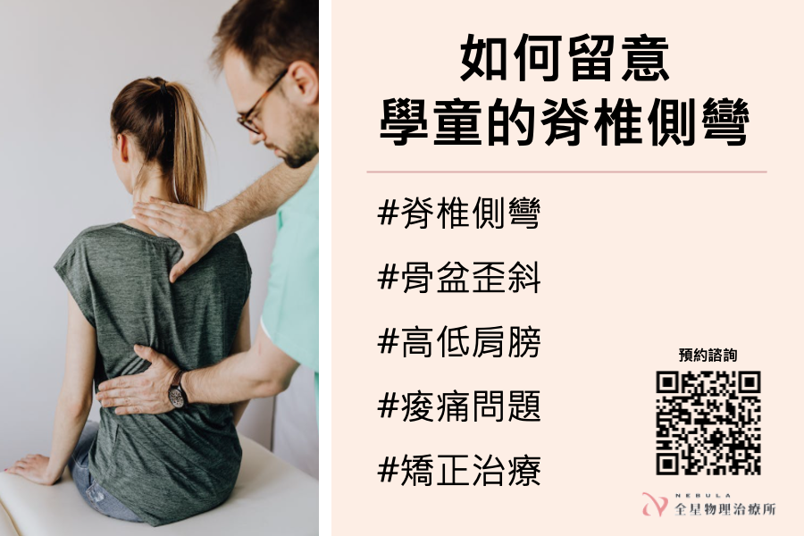 脊椎側彎