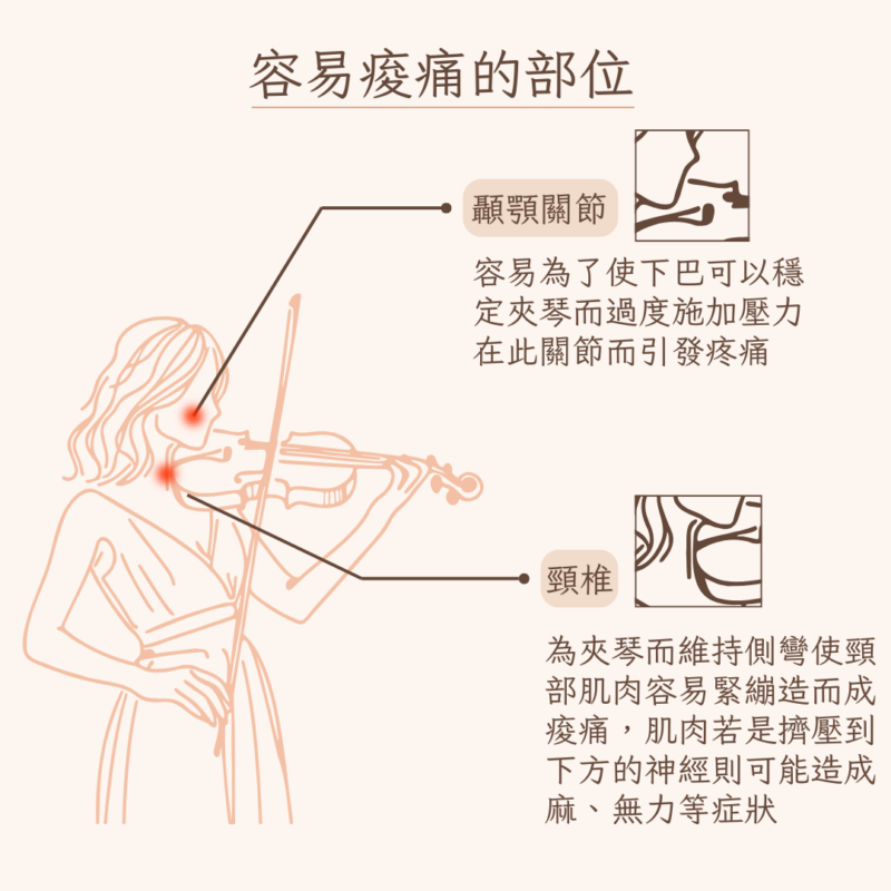 演奏者容易痠痛的部位