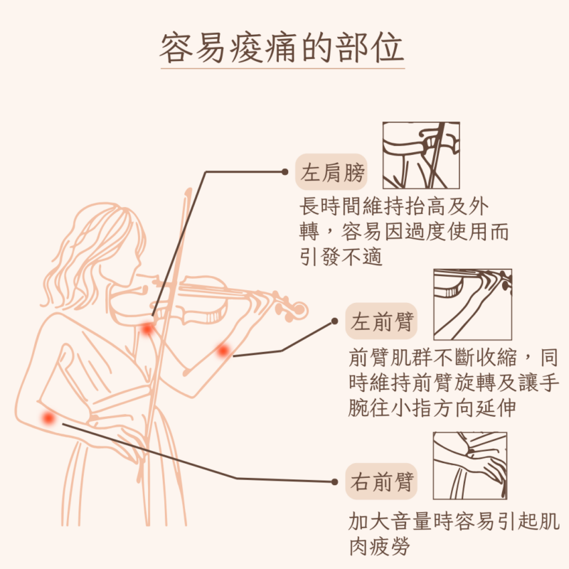 演奏者容易痠痛的部位