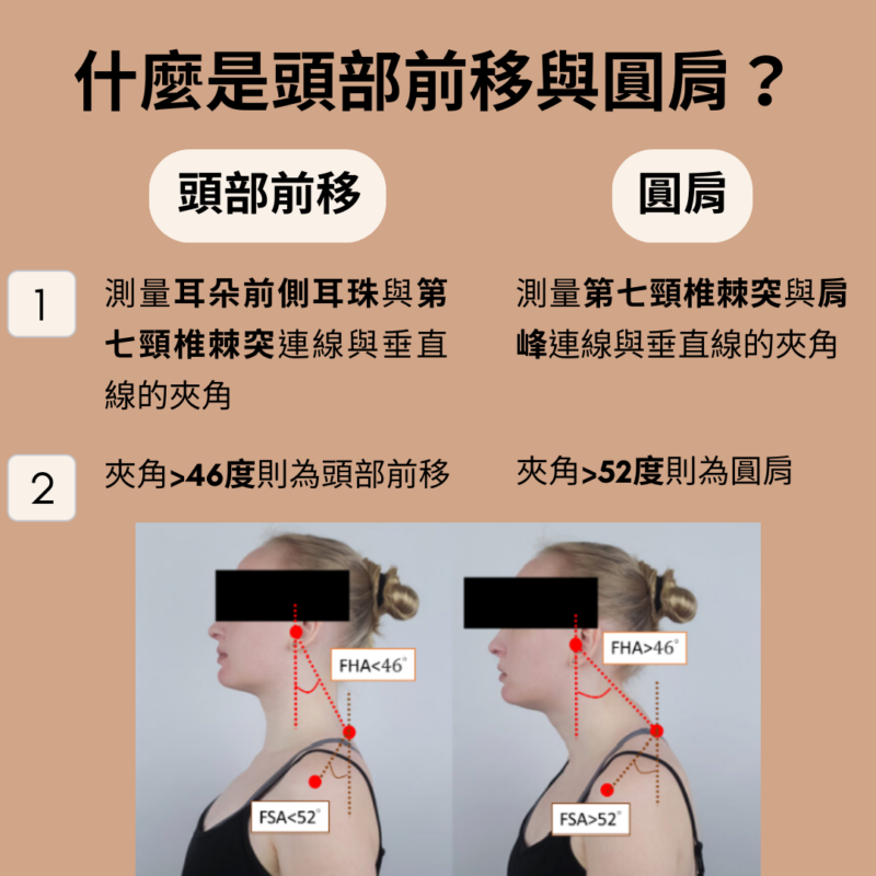 頭部前移與圓肩