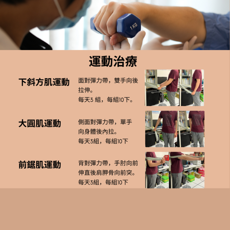 旋轉肌破裂,術後復健指南