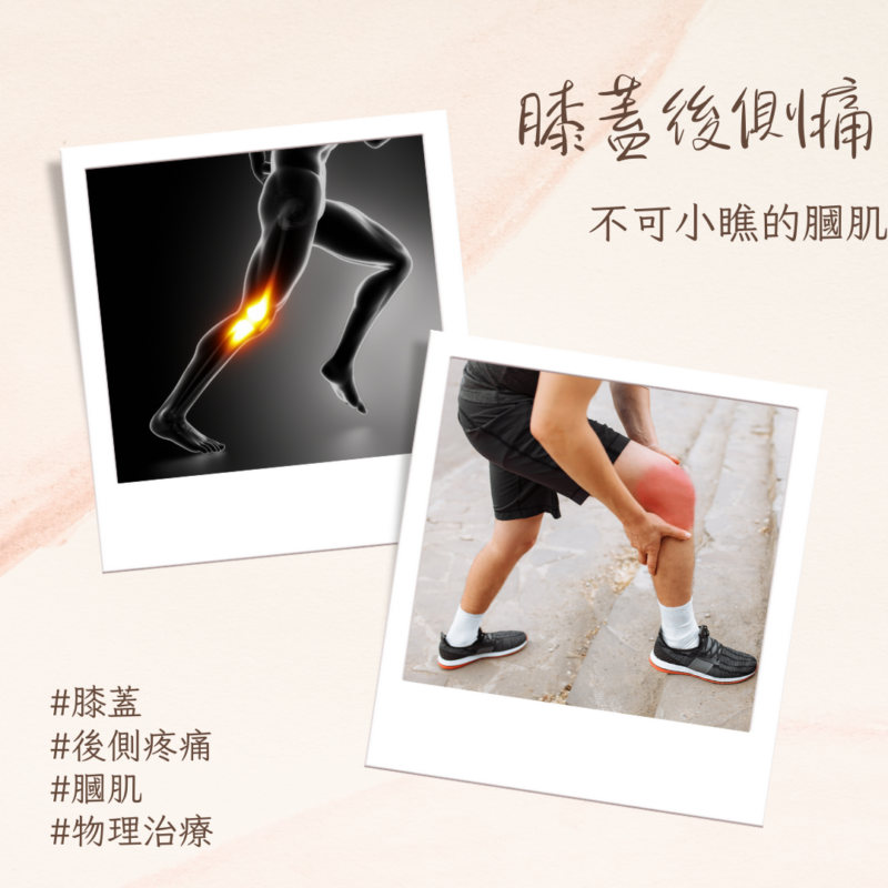 膝蓋後側痛，不可小瞧的膕肌