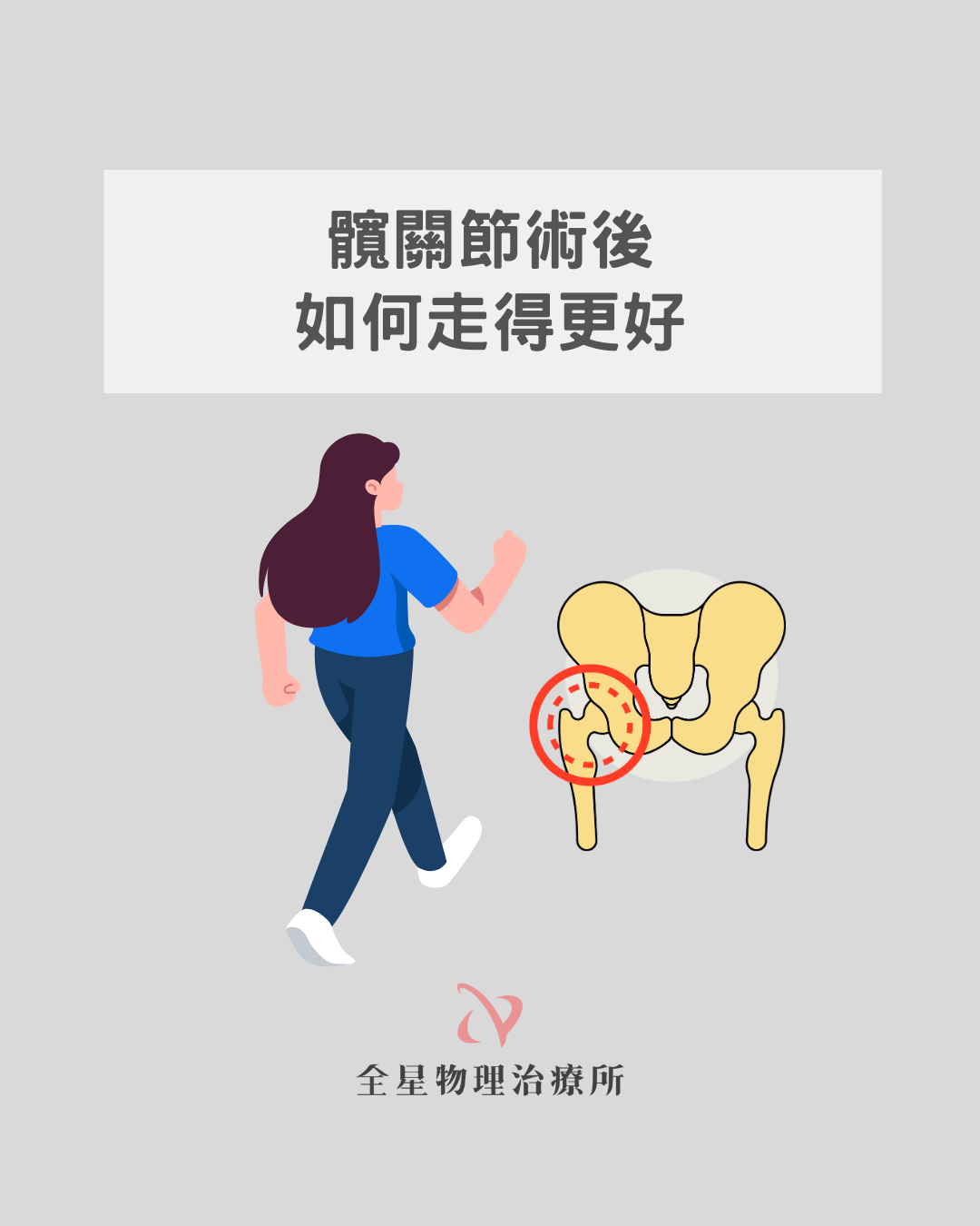 術後復健、復健運動、居家復健、髖關節手術、物理治療